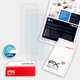 Lieferumfang von Amazfit X FX-ActiFleX Displayschutzfolie, Montage Zubehör inklusive