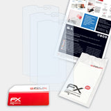 Lieferumfang von Crosscall Trekker X2 FX-Clear Schutzfolie, Montage Zubehör inklusive