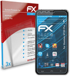 atFoliX FX-Clear Schutzfolie für Homtom HT30 Pro