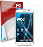 atFoliX FX-Clear Schutzfolie für LG G Pro Lite