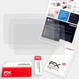 Lieferumfang von Mio MiVue 785 Touch FX-Antireflex Displayschutzfolie, Montage Zubehör inklusive