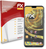 atFoliX FX-Antireflex Displayschutzfolie für Nokia 6.1 Plus