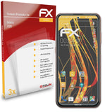 atFoliX FX-Antireflex Displayschutzfolie für Nokia X20