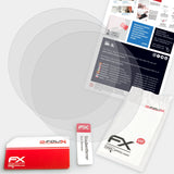 Lieferumfang von Philips DL8790/00 & DL8791/00 (Health Watch) FX-Antireflex Displayschutzfolie, Montage Zubehör inklusive