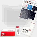 Lieferumfang von Rollei Actioncam 420 FX-Antireflex Displayschutzfolie, Montage Zubehör inklusive