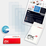 Lieferumfang von Sony Xperia 1 III FX-ActiFleX Displayschutzfolie, Montage Zubehör inklusive