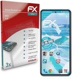 atFoliX FX-ActiFleX Displayschutzfolie für Vivo X70