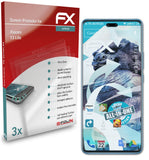 atFoliX FX-ActiFleX Displayschutzfolie für Xiaomi 13 Lite