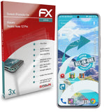 atFoliX FX-ActiFleX Displayschutzfolie für Xiaomi Redmi Note 12 Pro